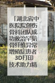 湖北省中医院院创伤骨科团队成功救治罕见骨纤维异常增殖症患者 3D打印技术助力精准矫形手术